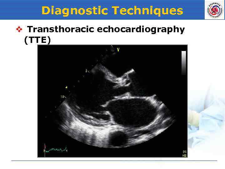 Diagnostic Techniques v Transthoracic echocardiography (TTE) 