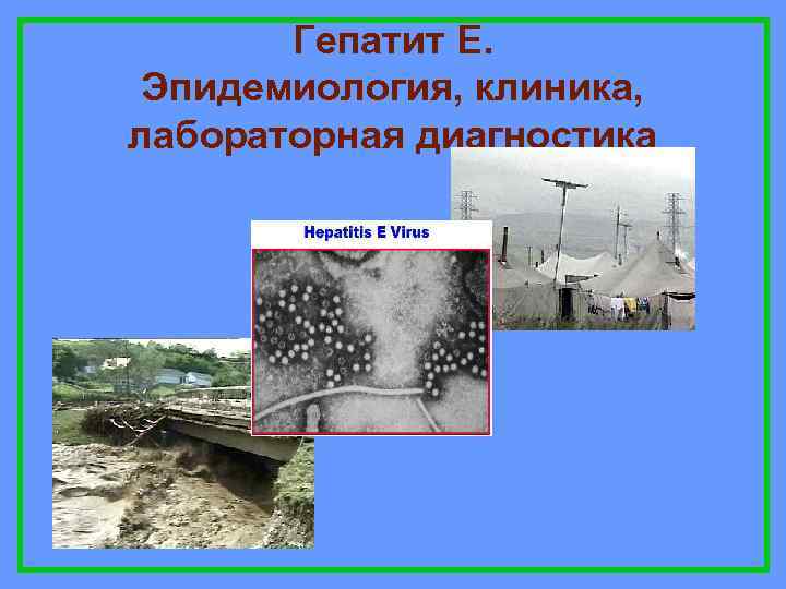 Гепатит Е. Эпидемиология, клиника, лабораторная диагностика 