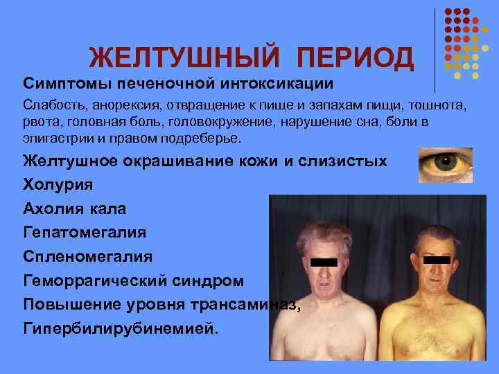 ЖЕЛТУШНЫЙ ПЕРИОД Симптомы печеночной интоксикации Слабость, анорексия, отвращение к пище и запахам пищи, тошнота,