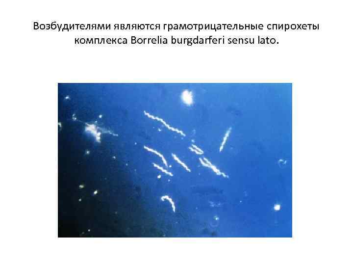 Возбудителями являются грамотрицательные спирохеты комплекса Borrelia burgdarferi sensu lato. 