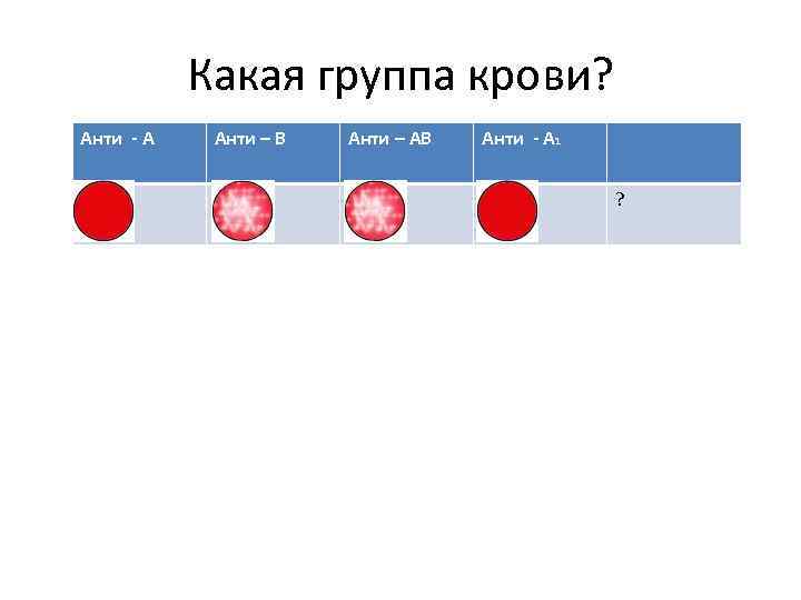 Какая группа крови? Анти - А Анти – В Анти – АВ Анти -