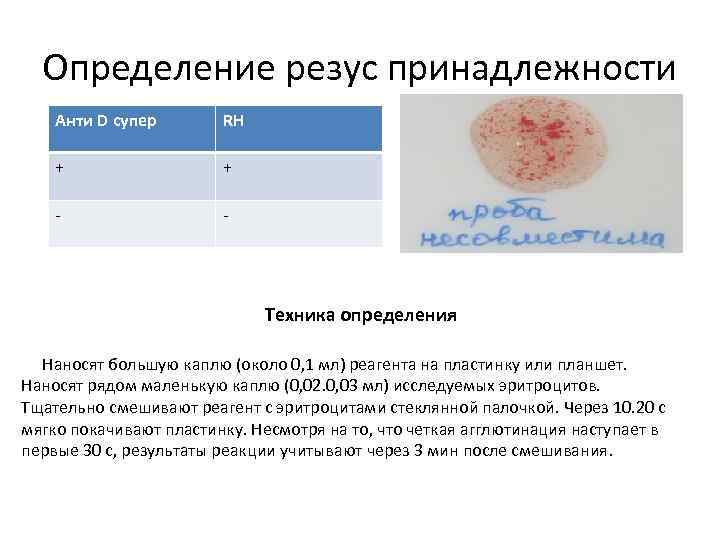 Определение резус принадлежности Анти D супер RH + + - - Техника определения Наносят