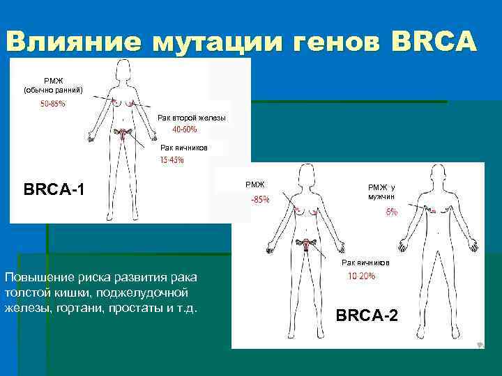 Влияние мутации генов BRCA РМЖ (обычно ранний) Рак второй железы Рак яичников BRCA-1 РМЖ