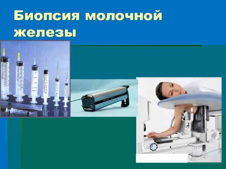 Биопсия молочной железы 