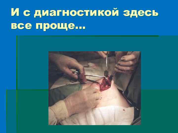 И с диагностикой здесь все проще… 