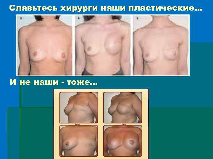 Славьтесь хирурги наши пластические… И не наши - тоже… 