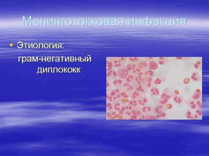 Менингококковая инфекция § Этиология: грам-негативный диплококк 