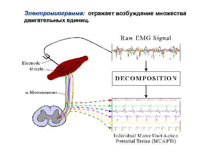 Электромиограмма: отражает возбуждение множества двигательных единиц. 
