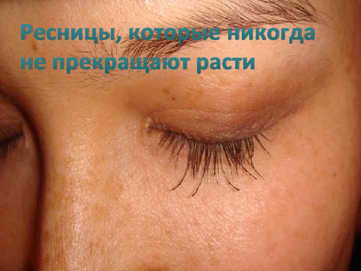 Ресницы, которые никогда не прекращают расти 
