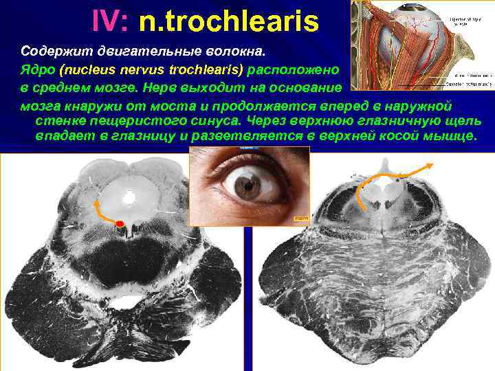 IV: n. trochlearis Содержит двигательные волокна. Ядро (nucleus nervus trochlearis) расположено в среднем мозге.
