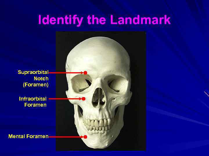 Identify the Landmark Supraorbital Notch (Foramen) Infraorbital Foramen Mental Foramen 