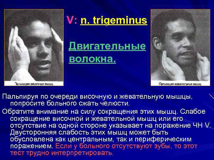 V: n. trigeminus Двигательные волокна. Пальпируя по очереди височную и жевательную мышцы, попросите больного