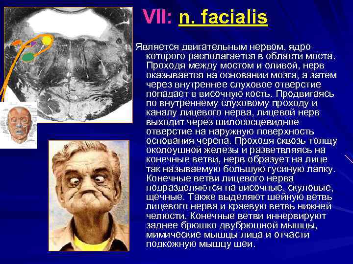  VII: n. facialis Является двигательным нервом, ядро которого располагается в области моста. Проходя