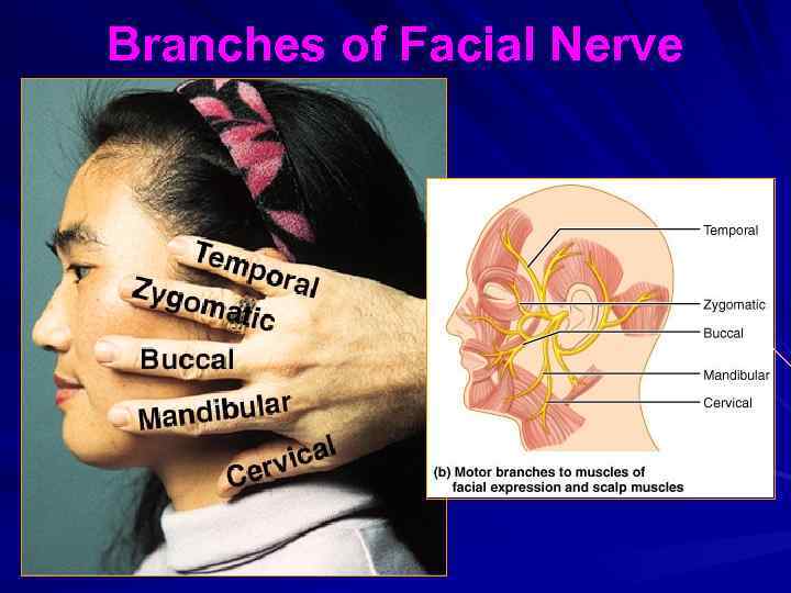 Branches of Facial Nerve 