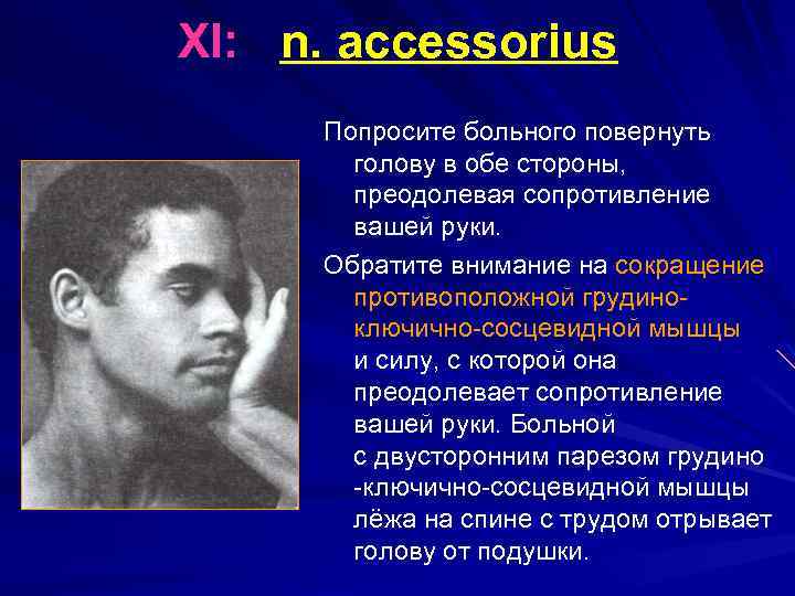 XI: n. accessorius Попросите больного повернуть голову в обе стороны, преодолевая сопротивление вашей руки.