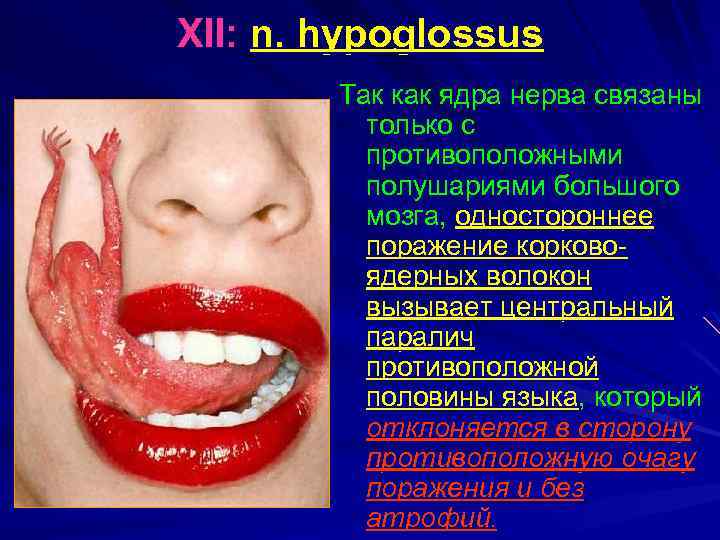XII: n. hypoglossus Так как ядра нерва связаны только с противоположными полушариями большого мозга,