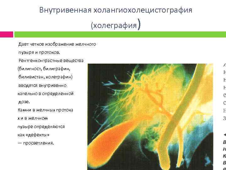 Внутривенная холангиохолецистография (холеграфия) Дает четкое изображение желчного пузыря и протоков. Рентгенконтрастные вещества (билигност, билиграфин,