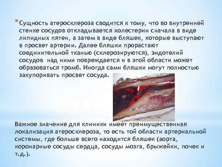 * Сущность атеросклероза сводится к тому, что во внутренней стенке сосудов откладывается холестерин сначала