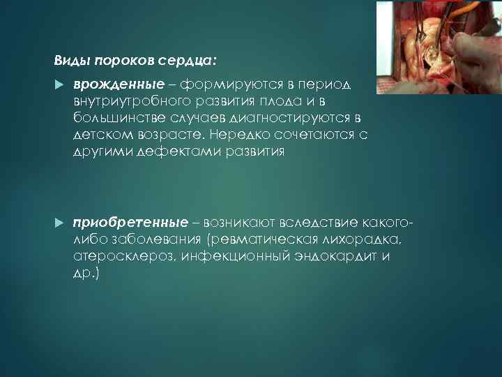 Виды пороков сердца: врожденные – формируются в период внутриутробного развития плода и в большинстве