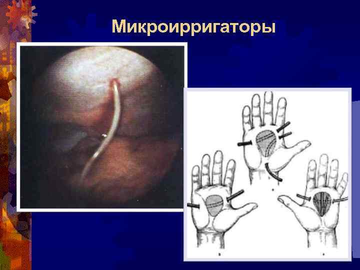 Микроирригаторы 