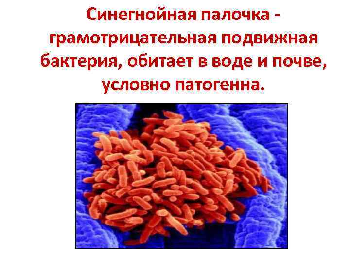 Синегнойная палочка - грамотрицательная подвижная бактерия, обитает в воде и почве, условно патогенна. 
