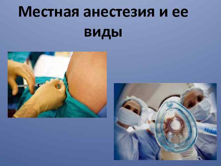 Местная анестезия и ее виды 