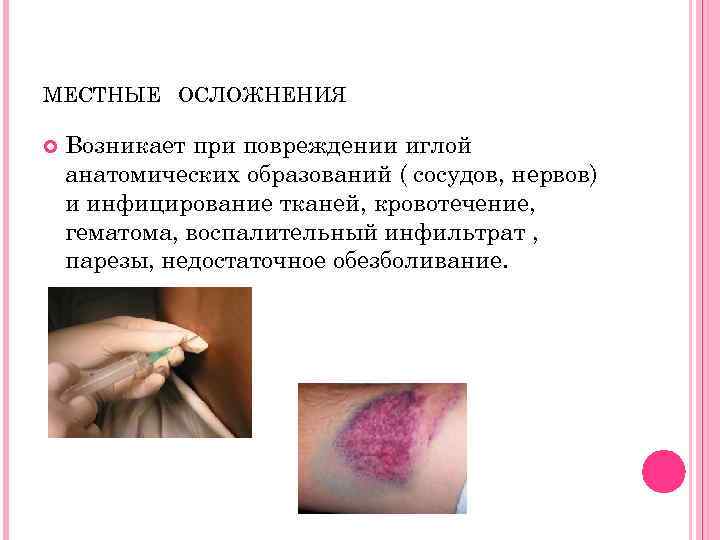 МЕСТНЫЕ ОСЛОЖНЕНИЯ Возникает при повреждении иглой анатомических образований ( сосудов, нервов) и инфицирование тканей,