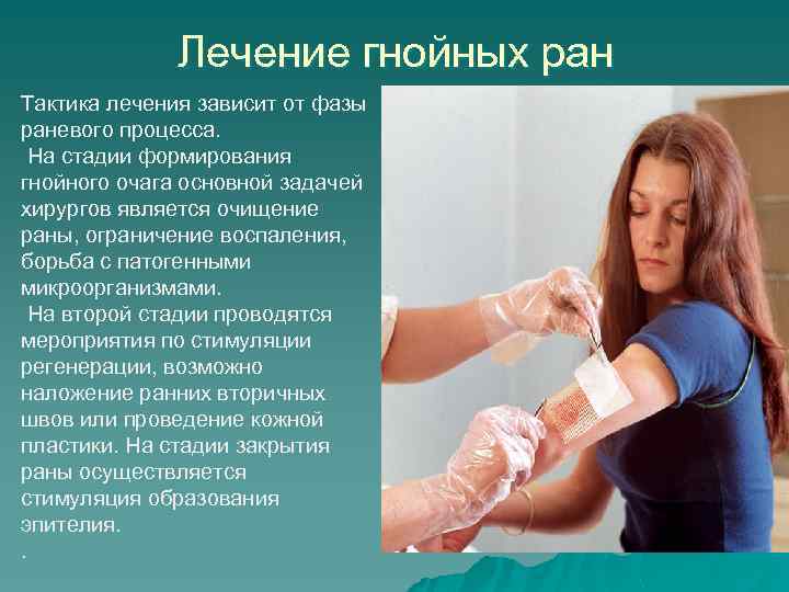 Лечение гнойных ран Тактика лечения зависит от фазы раневого процесса. На стадии формирования гнойного