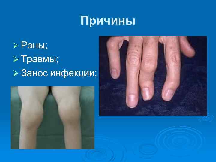 Причины Раны; Травмы; Занос инфекции; 