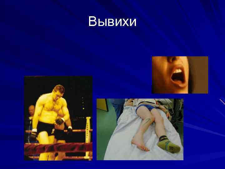Вывихи 