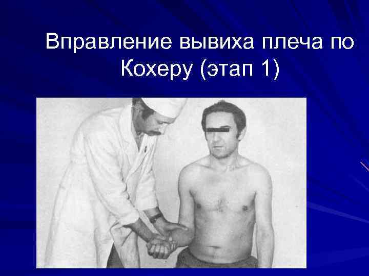 Вправление вывиха плеча по Кохеру (этап 1) 