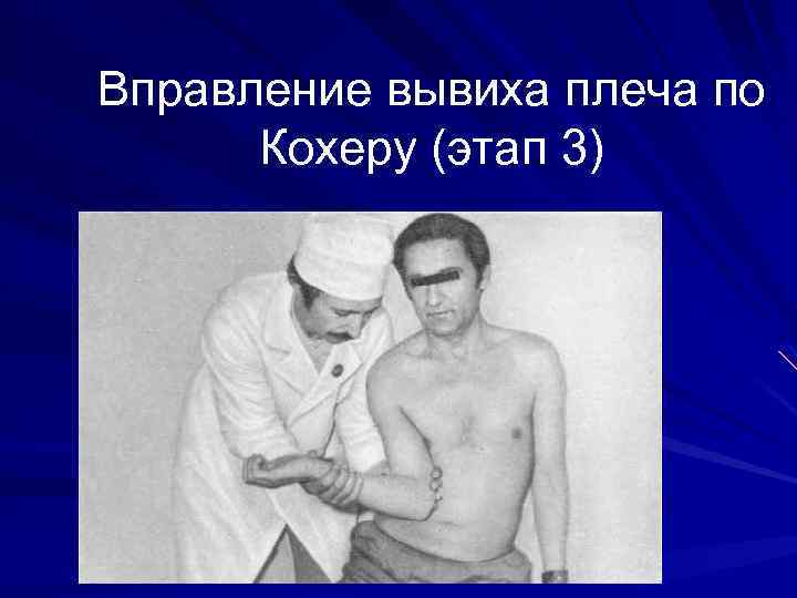 Вправление вывиха плеча по Кохеру (этап 3) 