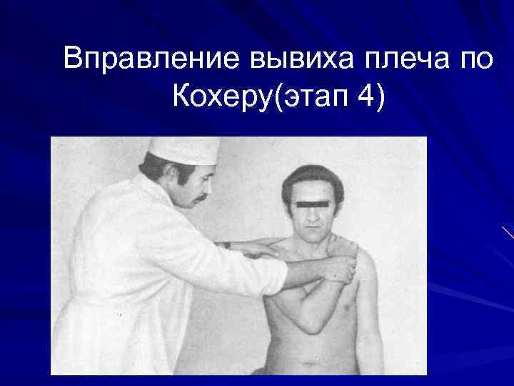 Вправление вывиха плеча по Кохеру(этап 4) 