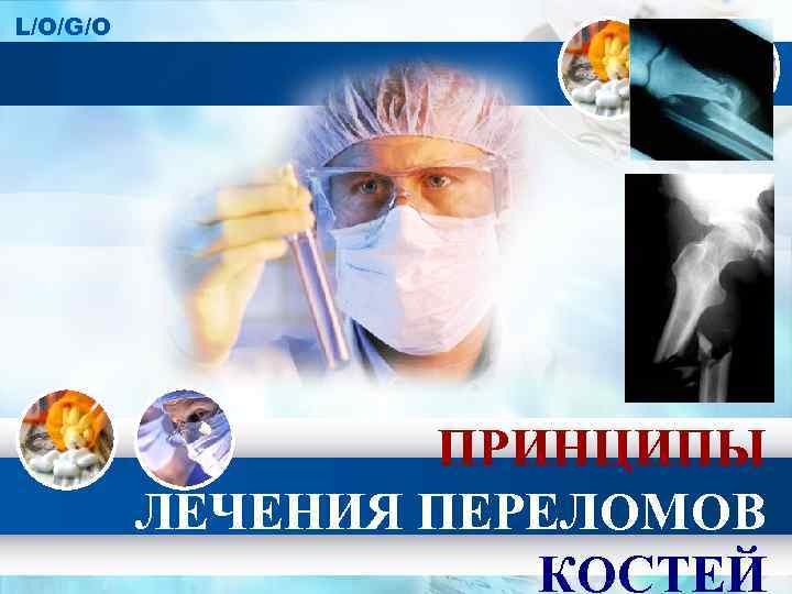 L/O/G/O ПРИНЦИПЫ ЛЕЧЕНИЯ ПЕРЕЛОМОВ КОСТЕЙ 