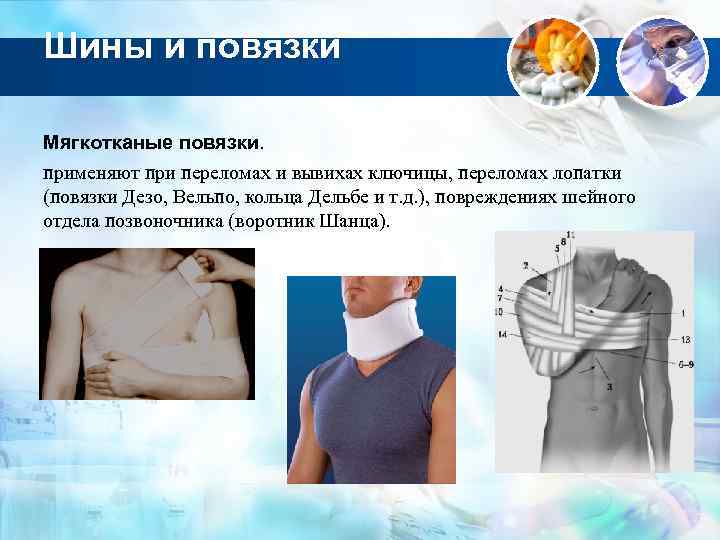 Шины и повязки Мягкотканые повязки. применяют при переломах и вывихах ключицы, переломах лопатки (повязки