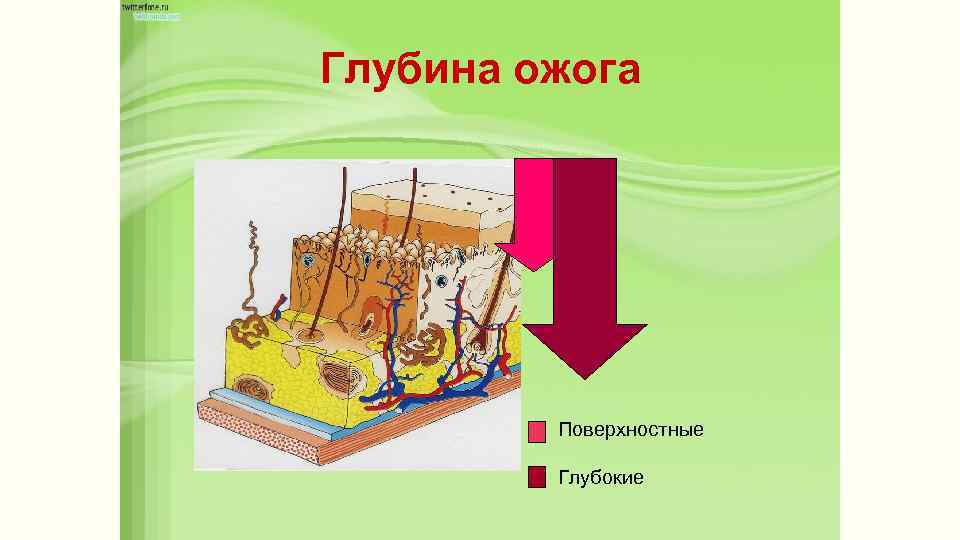 Глубина ожога Поверхностные Глубокие 