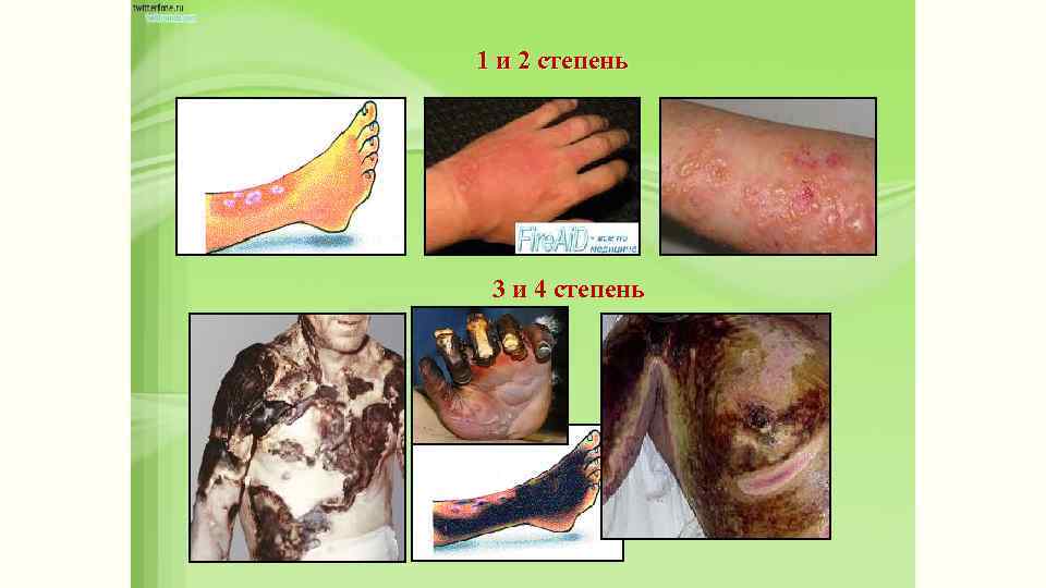 1 и 2 степень 3 и 4 степень 