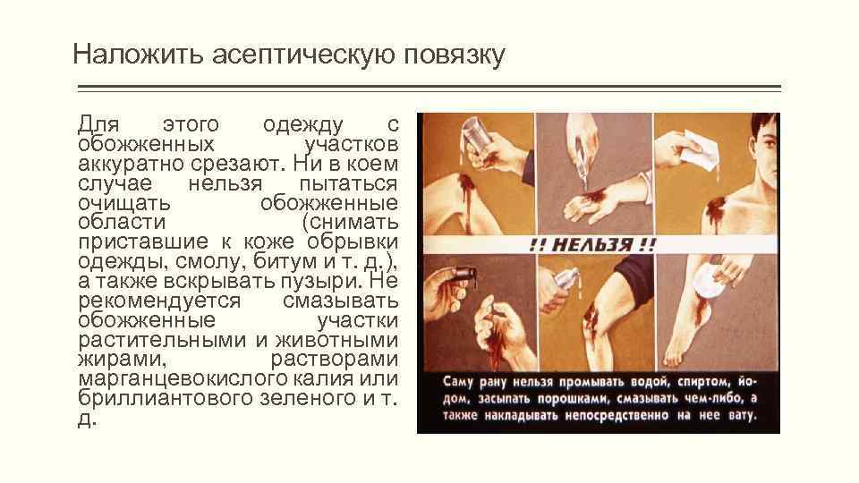 Наложить асептическую повязку Для этого одежду с обожженных участков аккуратно срезают. Ни в коем