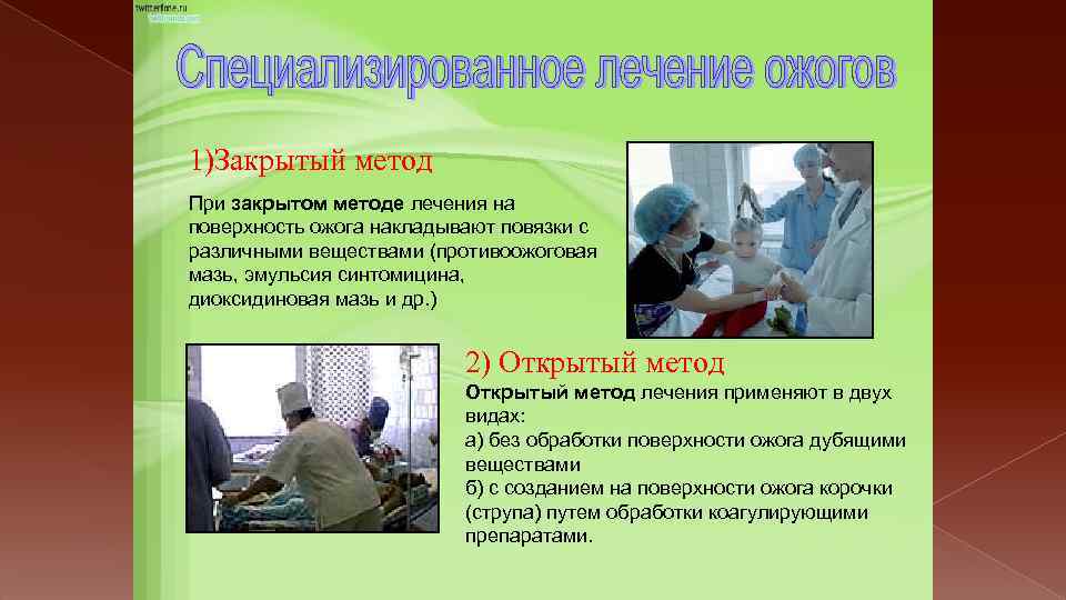 1)Закрытый метод При закрытом методе лечения на поверхность ожога накладывают повязки с различными веществами