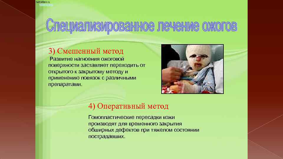 3) Смешенный метод Развитие нагноения ожоговой поверхности заставляет переходить от открытого к закрытому методу
