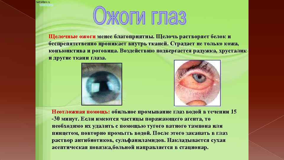 Щелочные ожоги менее благоприятны. Щелочь растворяет белок и беспрепятственно проникает внутрь тканей. Страдает не