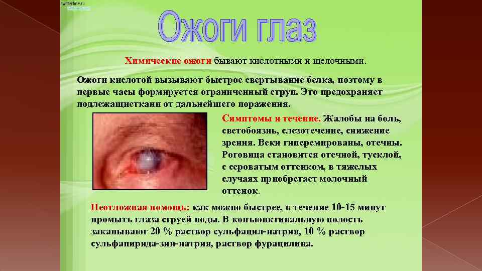 Химические ожоги бывают кислотными и щелочными. Ожоги кислотой вызывают быстрое свертывание белка, поэтому в