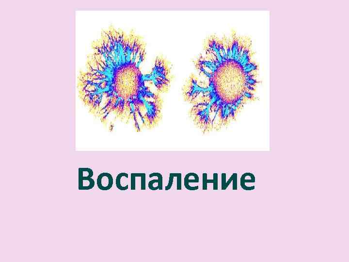 Воспаление 