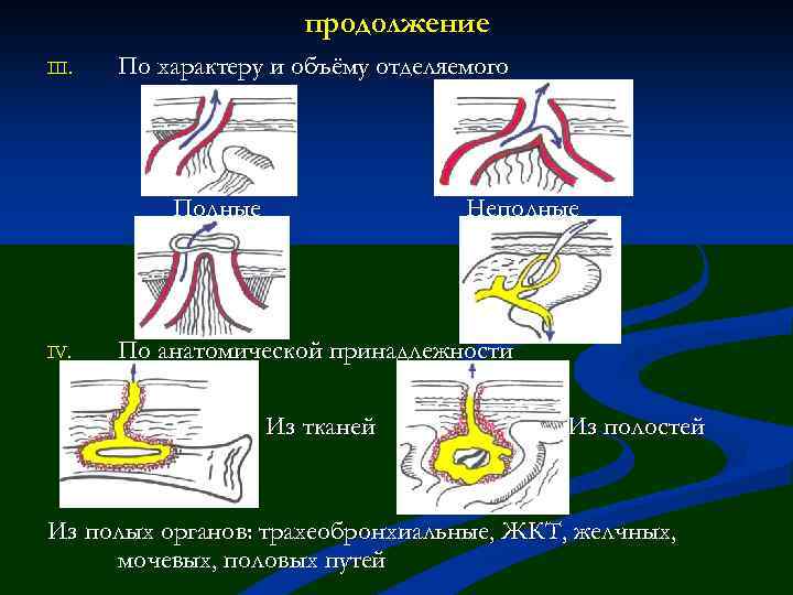 продолжение III. По характеру и объёму отделяемого Полные IV. Неполные По анатомической принадлежности Из