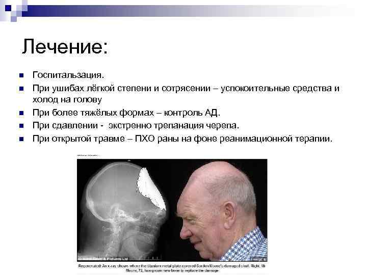 Лечение: n n n Госпитальзация. При ушибах лёгкой степени и сотрясении – успокоительные средства