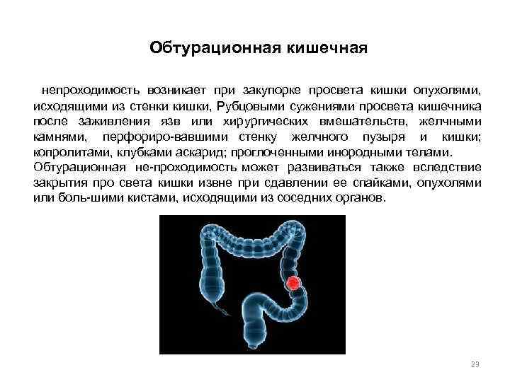 Обтурационная кишечная непроходимость возникает при закупорке просвета кишки опухолями, исходящими из стенки кишки, Рубцовыми