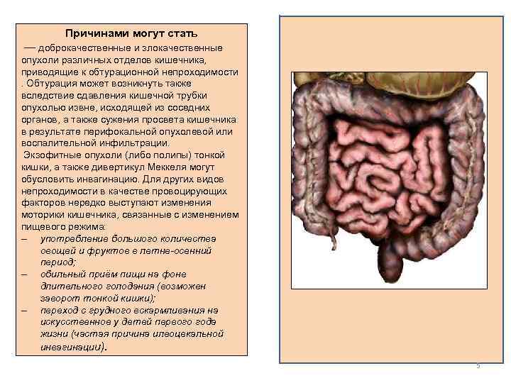 Причинами могут стать — доброкачественные и злокачественные опухоли различных отделов кишечника, приводящие к обтурационной