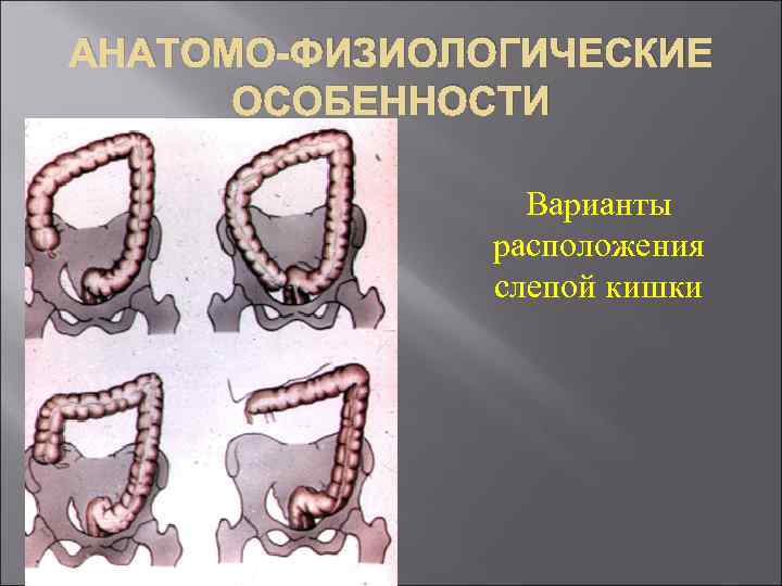 АНАТОМО-ФИЗИОЛОГИЧЕСКИЕ ОСОБЕННОСТИ Варианты расположения слепой кишки 