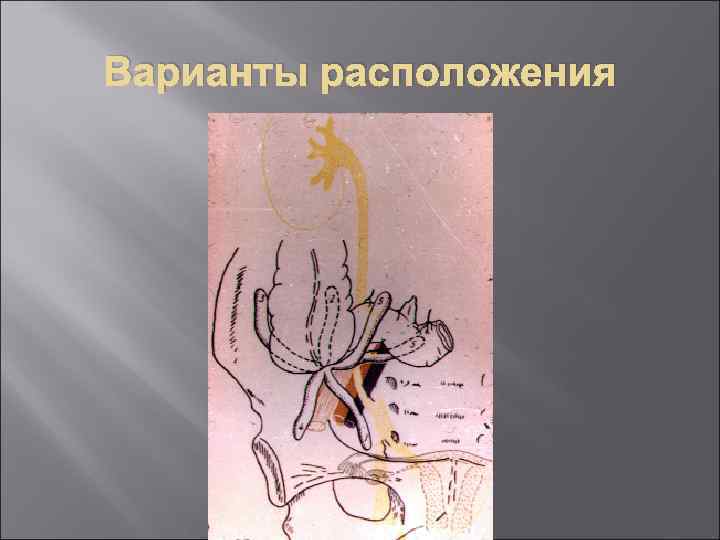 Варианты расположения 