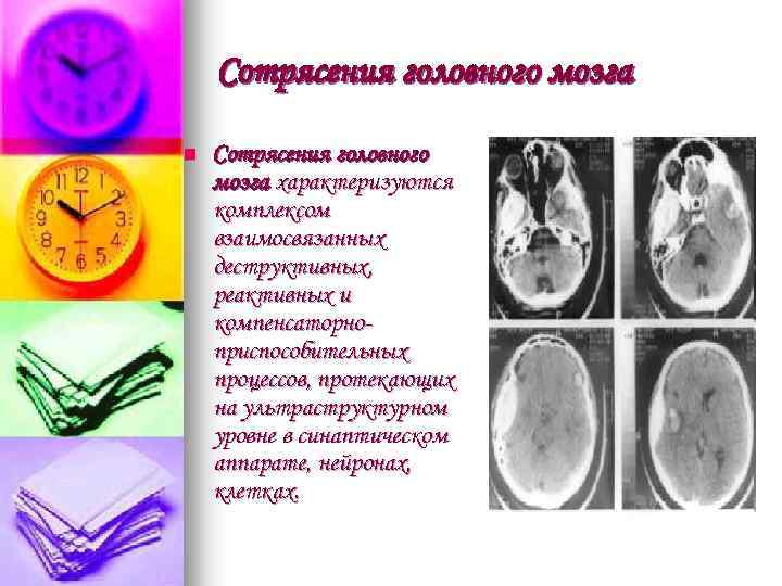 Сотрясения головного мозга n Сотрясения головного мозга характеризуются комплексом взаимосвязанных дестpуктивных, pеактивных и компенсатоpнопpиспособительных